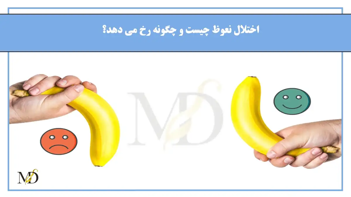 اثربخش‌ترین گیاهان دارویی برای تقویت نعوظ و رفع شلی آلت 